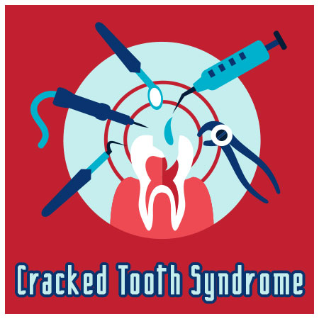 Germantown dentists, Dr. Liu & Dr. Lin at Clarksburg Dental Center, discuss causes, symptoms, and treatment of cracked tooth syndrome.